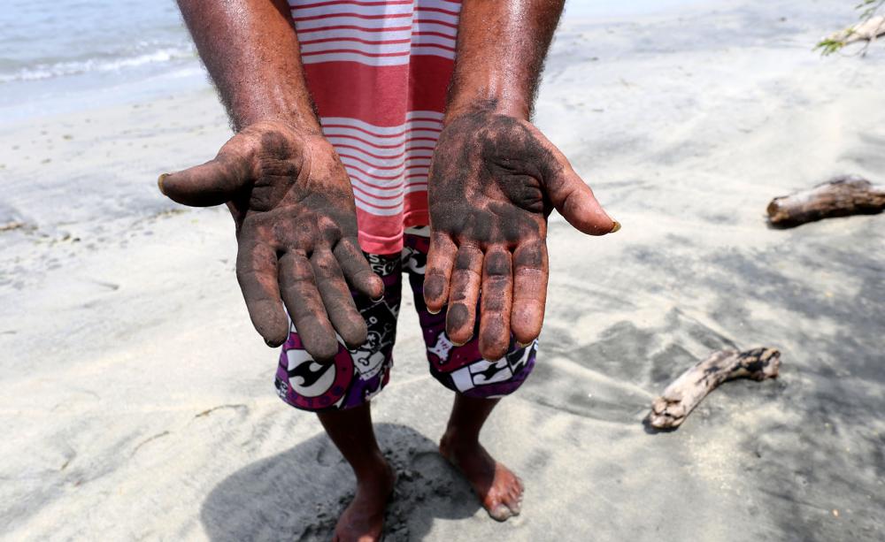Coal dust washed up on the beach marks the hands of a local villager in Columbia.