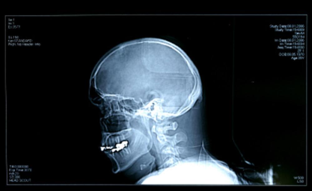 Brain scan