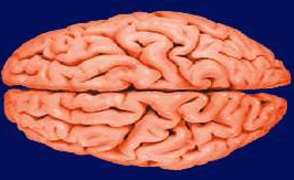 wet_brain.jpg